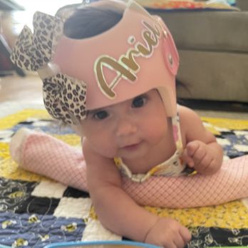 Achilles Prosthetics and Orthotics - Cranial helmet - Orthotics Near Me - Bakersfield, California