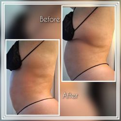 Luna Lilly Beautyy - Body sculpting