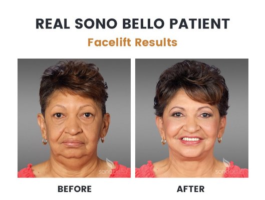 SONO BELLO Updated September 2025 25 Photos 11 Reviews 1 Mid L