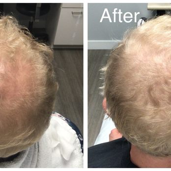 Complexions RX - Hair restoration - Skin Care Near Me - San Diego, California Complexions RX - Hair restoration - Skin Care Near Me - San Diego, California