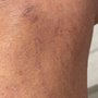 Photo of Apex Vein and Vascular Institute