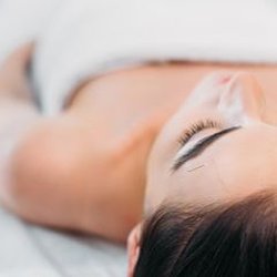 Enterprise Therapy Center - What to Know About Dry Needling and Physical Therapy