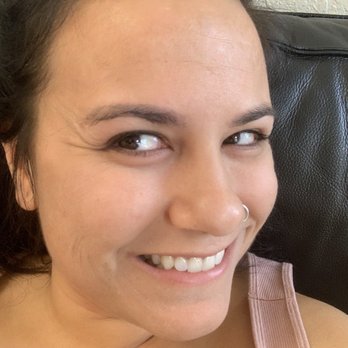 Confident Complexion Skin Care - Acne Treatment Near Me - San Diego, California