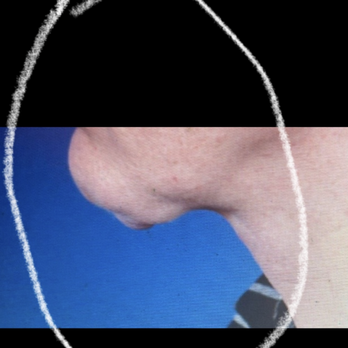 John Harbison - Cosmetic Surgeons Near Me - Elkhorn, Nebraska John Harbison - Cosmetic Surgeons Near Me - Elkhorn, Nebraska