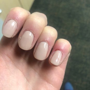 My Nail Salon - Ripped off my cuticle (and I have my engagement photo shoot today!) - Nail Salons Near Me - Boston, Massachusetts My Nail Salon - Ripped off my cuticle (and I have my engagement photo shoot today!) - Nail Salons Near Me - Boston, Massachusetts