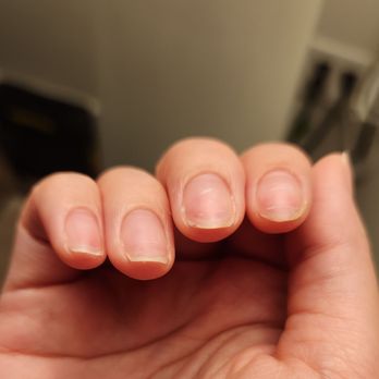 Peridot Nails & Spa - Today, after gelx removal with Kelly - cut too short, super thin, red, tender to the touch. I'm livid. - Nail Salons Near Me - Monrovia, California Peridot Nails & Spa - Today, after gelx removal with Kelly - cut too short, super thin, red, tender to the touch. I'm livid. - Nail Salons Near Me - Monrovia, California
