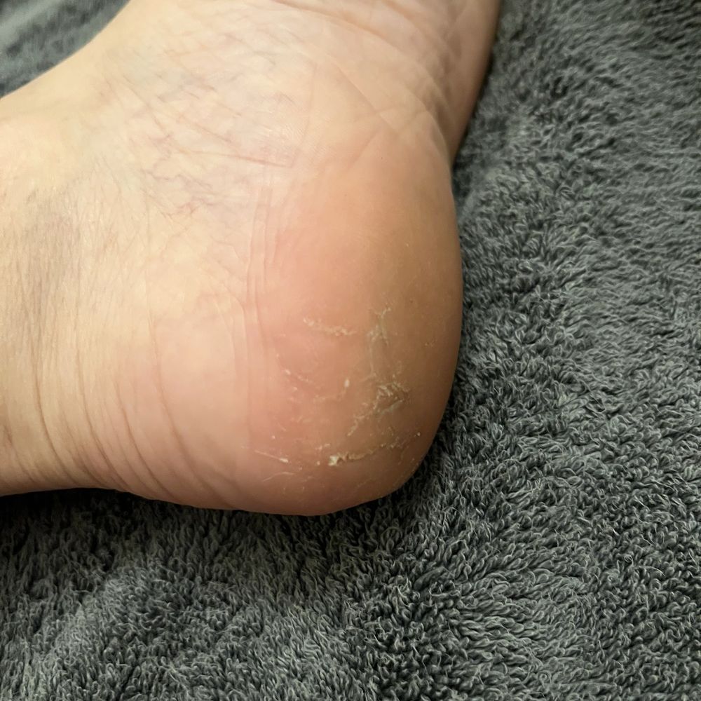 Top Nails Salon & Spa - Lesson learned: Inspect more than the polish before offering a tip. - Nail Salons Near Me - Cincinnati, Ohio Top Nails Salon & Spa - Lesson learned: Inspect more than the polish before offering a tip. - Nail Salons Near Me - Cincinnati, Ohio