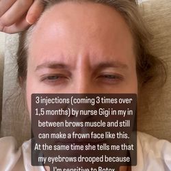 Genevieve Vielbig NP-BC - Bad Botox by nurse Gigi