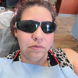 Familia Dental - My face all numbed from the injections.