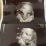 Photo of Jack and Jill Fetal Photos