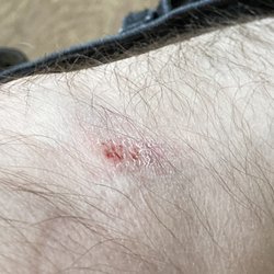 Cabrillo Liquor & Delicatessen - My knee