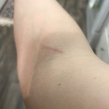 Labcorp - How one must hate people to draw the blood like that - Laboratory Testing Near Me - Pleasant Hill, California