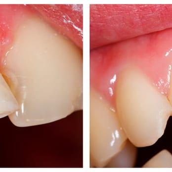 Emerald Dental Practice - Teeth Whitening - Cosmetic Dentists Near Me - Oceanside, California Emerald Dental Practice - Teeth Whitening - Cosmetic Dentists Near Me - Oceanside, California