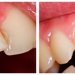 Emerald Dental Practice - Teeth Whitening
