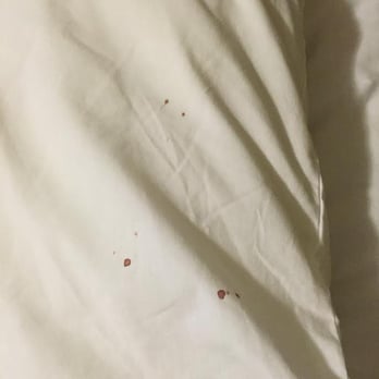 Found These Old Blood Stains On My Pillow Yelp