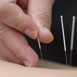 Natural Health - Acupuncture