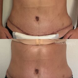 EnVision Beauty - Post op care post mommy make over