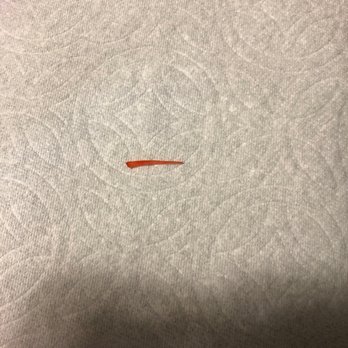 Chinese Restaurant - Piece of plastic in Orange Chicken - Chinese Near Me - Metairie, Louisiana