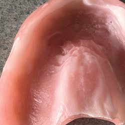 Dental Dreams - Was never told these were temporary dentures. So they were going to make me new ones, take these. And no teeth for 2 months.