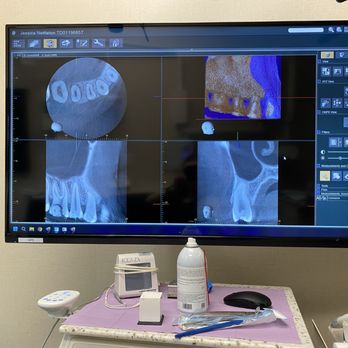 Creekside Endodontics - Thorough x-rays and details to my needs - Endodontists Near Me - Folsom, California Creekside Endodontics - Thorough x-rays and details to my needs - Endodontists Near Me - Folsom, California