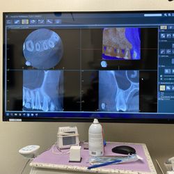 Creekside Endodontics - Thorough x-rays and details to my needs