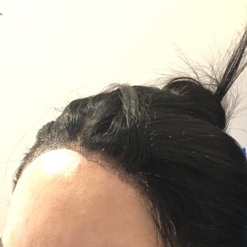 Miracle Wigs & Hair - Hair Loss Centers Near Me - Bronx, New York