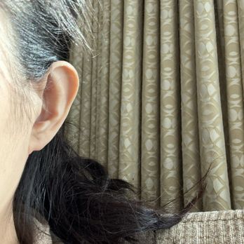 James Newman, MD - Premier Plastic Surgery - Left ear- done so wrong. Still extrude out. - Plastic Surgeons Near Me - San Mateo, California