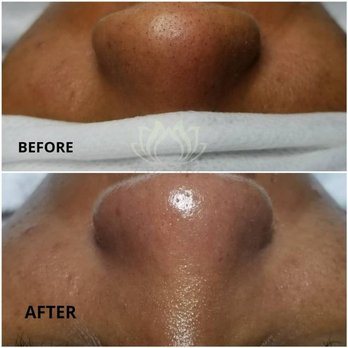 Escape Massage & Esthetics Studio - Clean pores! - Massage Therapy Near Me - Manchester, Connecticut Escape Massage & Esthetics Studio - Clean pores! - Massage Therapy Near Me - Manchester, Connecticut