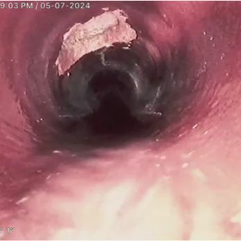 Triple G Hydrojetting - Found broken pipe root intrusion. - Hydro-jetting Near Me Triple G Hydrojetting - Found broken pipe root intrusion. - Hydro-jetting Near Me