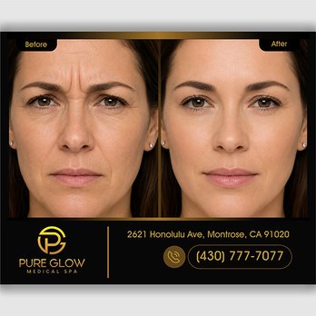 Pure Glow Medical Spa - Medical Spas Near Me - Montrose, California Pure Glow Medical Spa - Medical Spas Near Me - Montrose, California