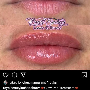 Luxsy Xthetics - Before and after - Teeth Whitening Near Me - Las Vegas, Nevada Luxsy Xthetics - Before and after - Teeth Whitening Near Me - Las Vegas, Nevada