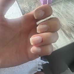 Famous Nails - It hurts. It was bleeding more after this pic.