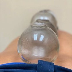 East Lake Acupuncture