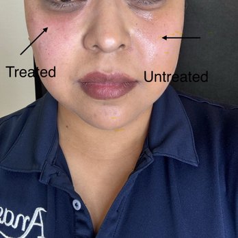 Rarre Aesthetics & Wellness - Prp Cellenis - Medical Spas Near Me - Placentia, California Rarre Aesthetics & Wellness - Prp Cellenis - Medical Spas Near Me - Placentia, California