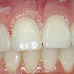 Christopher M Herman, DDS - Actual Patient After Photo