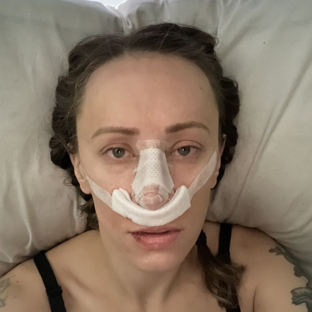 drmichaelkim Facial Plastic Surgery - Right after surgery - Plastic Surgeons Near Me - Portland, Oregon