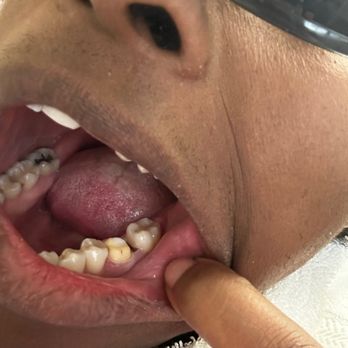 Richard H Tabor, DDS - They performed a perfect crown on my tooth that has been a problem for me for some time. - General Dentistry Near Me - Alameda, California