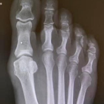 Jeremy Evans, DPM - Before surgery! - Podiatrists Near Me - Sacramento, California Jeremy Evans, DPM - Before surgery! - Podiatrists Near Me - Sacramento, California