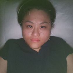 Laura Acupuncture Clinic - Come in today for sinus and migraines pain . Great relief