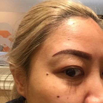 Annwu Skin Care - Post tattoo, initially! - Skin Care Near Me - San Gabriel, California