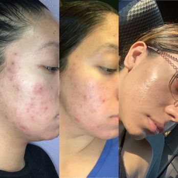 S.b.h Studio - Results! - Estheticians Near Me - Corona, California