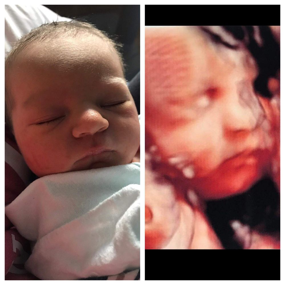 Before Birth Bonding - social services organization in Burlington, VT