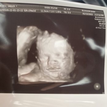 Blossom Baby - Diagnostic Imaging Near Me - Oceanside, California Blossom Baby - Diagnostic Imaging Near Me - Oceanside, California