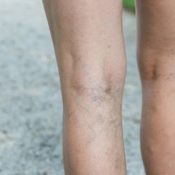 Jersey Shore Foot & Leg Center