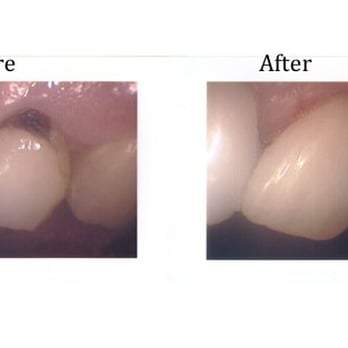 Irving J Leonard, DDS - Oral Surgeons Near Me - Chicago, Illinois