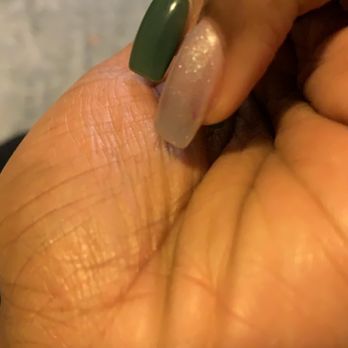Luxy Nails Spa - Red spots on nail - Nail Salons Near Me - Covington, Georgia