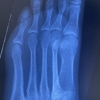 Jason Khadavi, DPM - Xray - Podiatrists Near Me - Beverly Hills, California