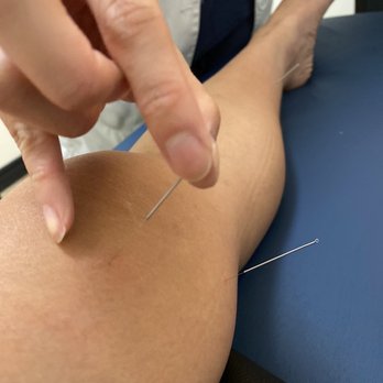 Rapha Acupuncture and Herbs - Acupuncture Near Me - Arcadia, California Rapha Acupuncture and Herbs - Acupuncture Near Me - Arcadia, California