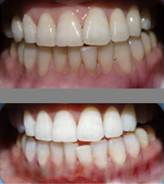 DAVINCI TEETH WHITENING SYSTEMS Updated May 2024 1806 S Alpine Rd, Rockford, Illinois