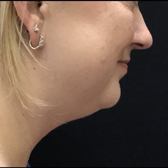 Jeff Healy, MD - Pre Op Day - Cosmetic Surgeons Near Me - Aiea, Hawaii Jeff Healy, MD - Pre Op Day - Cosmetic Surgeons Near Me - Aiea, Hawaii